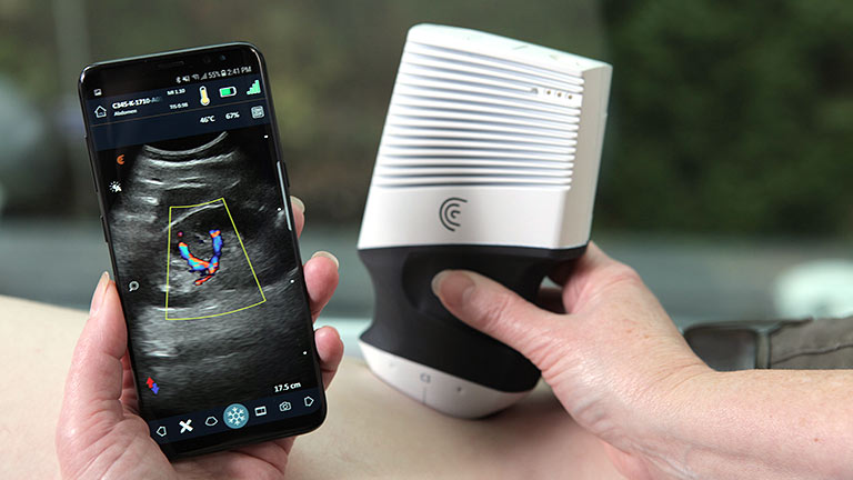 person using small ultrasound device and smartphone to examine patient